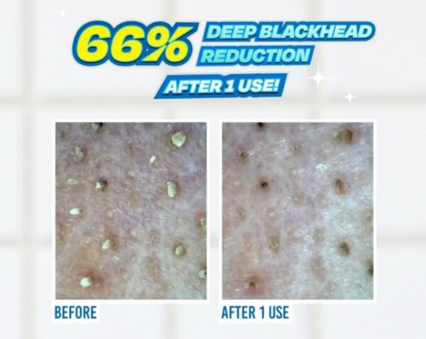 JUMISO, Blackhead Melting Softener & Cotton Pad Set 150ml