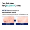 img_0821.jpeg Mediheal, Madecassoside Blemish Pads 100pcs مسحات ميدهيل لعلاج الحبوب