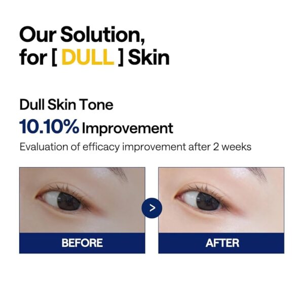 img_0827.jpeg Mediheal, Vitamide Brightening Pads 100pcs مسحات ميدهيل فيتامين سي للتفتيح وعلاج التصبغات