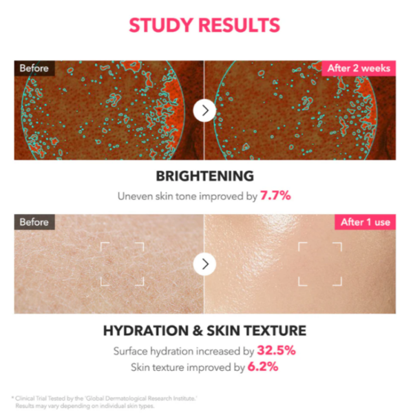 APRILSKIN, TXA Niacinamide 99 Milky Toner 150ml