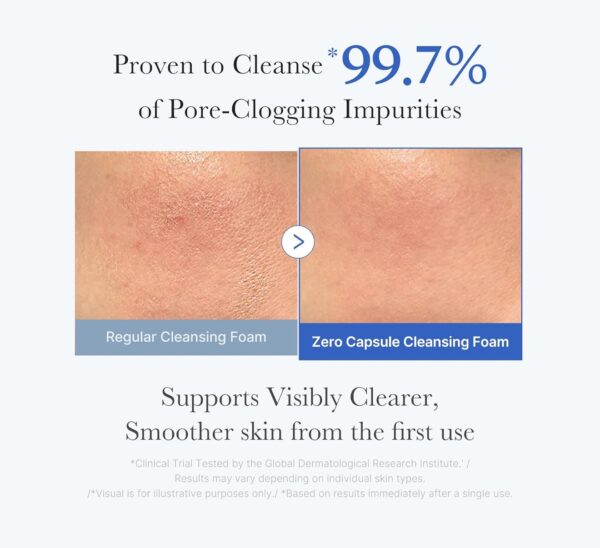 medicube Zero Pore Clear SA Blue Capsule Facial Cleanser for Skin Texture Blackhead & Pore Care  150g