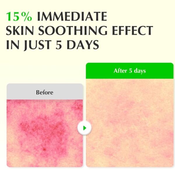 img_2360.jpeg EQQUALBERRY - Aloe PDRN Calming Serum 30ml