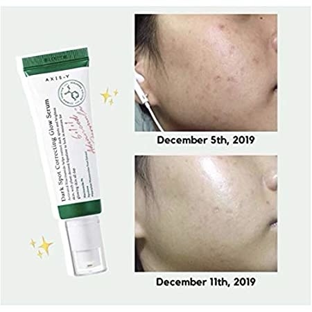 AXIS-Y, Dark Spot Correcting Niacinamide Glow Serum 50ml