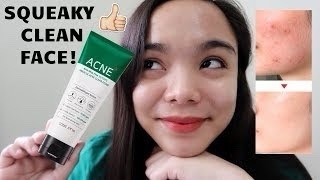 Some By Mi, AHA BHA PHA 30 Days Miracle Acne Clear Foam 100ml 
غسول المعجزة العلاجي للحبوب من سوم باي مي