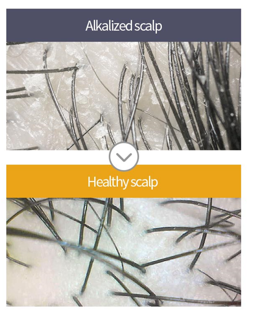 A'PIEU, Raspberry Hair Vinegar 200ml
تونر خل التوت للشعر لعلاج القشرة ودهنية الفروة