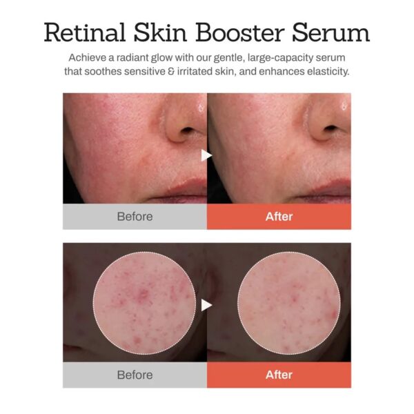 img_2655.jpeg Meditherapy - Retinal Skin Booster Serum سيروم توحيد لون الوجه و الجسم