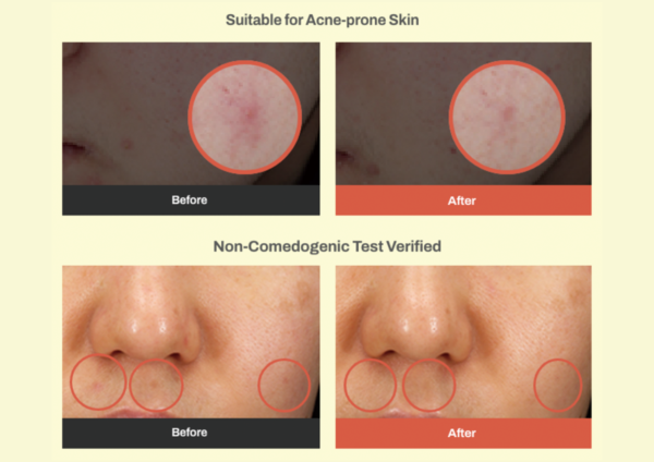 img_2656.png Meditherapy - Retinal Skin Booster Serum سيروم توحيد لون الوجه و الجسم