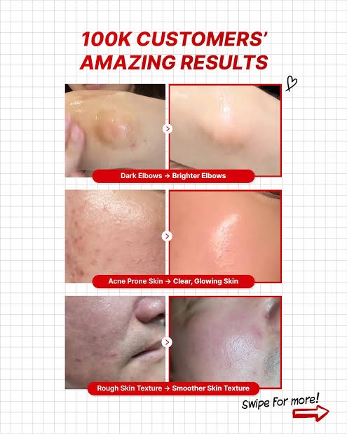 img_2657.jpeg Meditherapy - Retinal Skin Booster Serum سيروم توحيد لون الوجه و الجسم