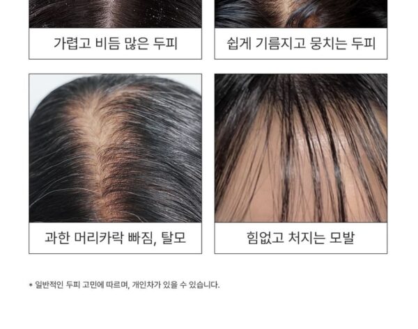 img_2913.jpeg Purcell Pixcell Biom™ Tonic for Hair Density تونيك لتكثيف الشعر وعلاج التساقط