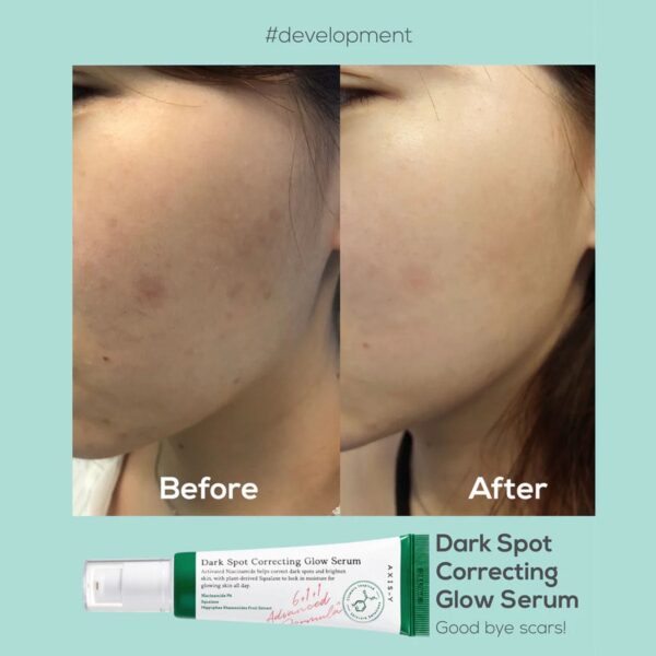 axis y dark spot correcting glow serum