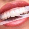 SmileKit Pap+ Teeth whitening strips 28 pcs