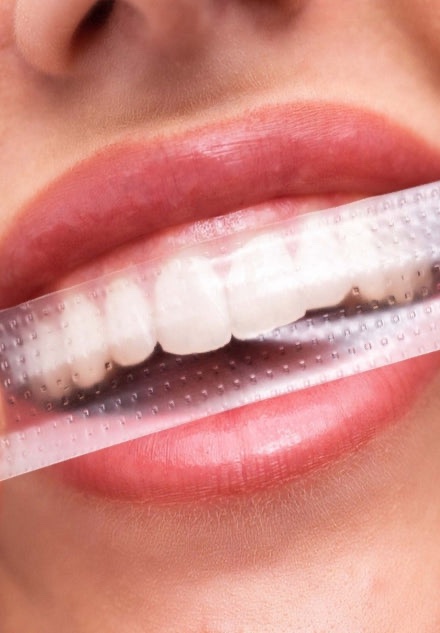 SmileKit Pap+ Teeth whitening strips 28 pcs