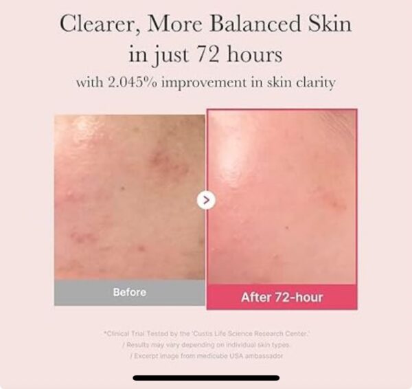 img_5956.jpeg Medicube - TXA Niacinamide 15 Serum 30ml