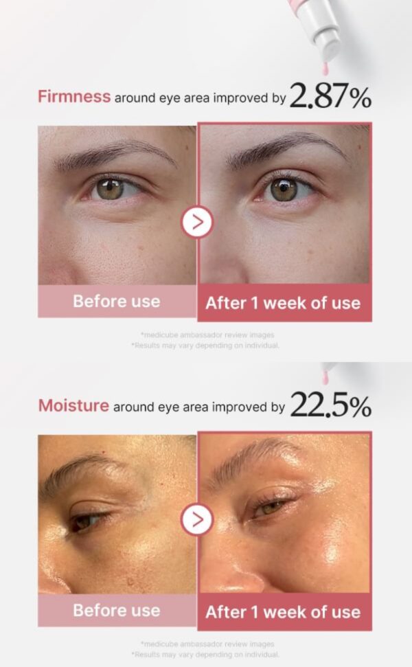 img_6866.jpeg MEDICUBE PDRN PINK Peptide Eye Cream 30ml