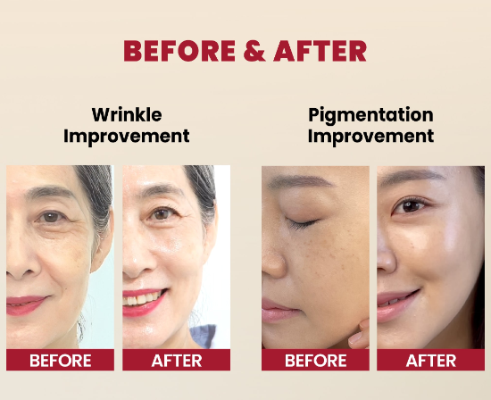 KSECRET, SEOUL 1988 : Retinal Liposome  2% + Black Ginseng Cream 30ml