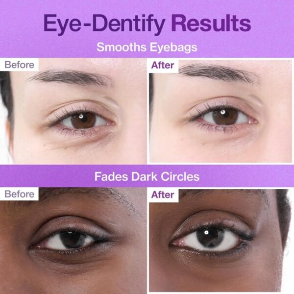 img_6877 Numbuzin 9+ NAD+ Collagen Eye Patches 5 pairs